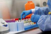 Armenia to produce coronavirus test kits